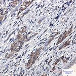 ZFYVE9 Recombinant Rabbit Monoclonal Antibody (K01_2P39)