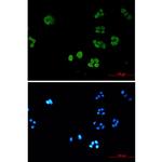 SBDS Recombinant Rabbit Monoclonal Antibody (K01_2P40)