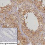 SEMA7A Recombinant Rabbit Monoclonal Antibody (K01_2P42)