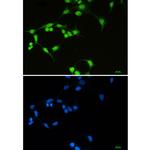 SF3B1 Recombinant Rabbit Monoclonal Antibody (K01_2P45)