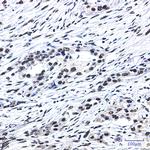 SF3B1 Antibody in Immunohistochemistry (Paraffin) (IHC (P))