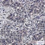 UBE2D1 Recombinant Rabbit Monoclonal Antibody (K01_2P46)