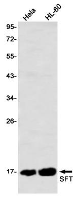 UBE2D1 Antibody in Western Blot (WB)
