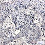 SMARCA2 Antibody in Immunohistochemistry (Paraffin) (IHC (P))