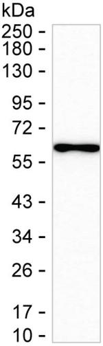 SMARCD1 Recombinant Rabbit Monoclonal Antibody (K01_2P51)