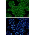SNX1 Recombinant Rabbit Monoclonal Antibody (K01_2P52)