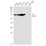 SNX1 Antibody in Western Blot (WB)