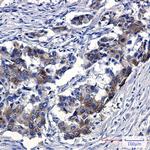 Sortilin Recombinant Rabbit Monoclonal Antibody (K01_2P53)