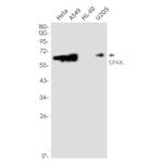 STK39 Antibody in Western Blot (WB)