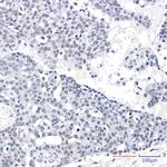 SPT5 Antibody in Immunohistochemistry (Paraffin) (IHC (P))