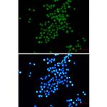 SV40 T-Antigen Recombinant Rabbit Monoclonal Antibody (K01_2P63)