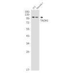 TAOK1 Recombinant Rabbit Monoclonal Antibody (K01_2P66)
