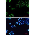 TBP Recombinant Rabbit Monoclonal Antibody (K01_2P67)