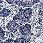 TCP1 Antibody in Immunohistochemistry (Paraffin) (IHC (P))