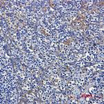 DYNLT1 Antibody in Immunohistochemistry (Paraffin) (IHC (P))