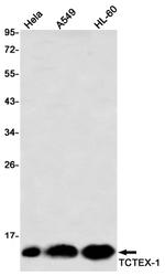 DYNLT1 Antibody in Western Blot (WB)