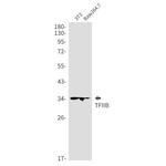 GTF2B Antibody in Western Blot (WB)