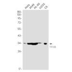 GTF2B Recombinant Rabbit Monoclonal Antibody (K01_2P72)