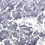 Torc2 Recombinant Rabbit Monoclonal Antibody (K01_2P79)