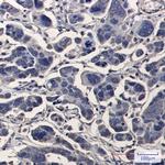 TPMT Recombinant Rabbit Monoclonal Antibody (K01_2P80)