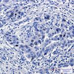 TPX2 Antibody in Immunohistochemistry (Paraffin) (IHC (P))