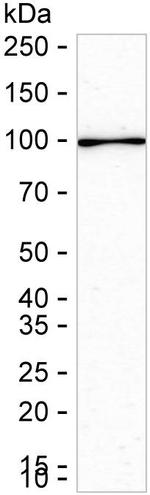 TPX2 Antibody in Western Blot (WB)