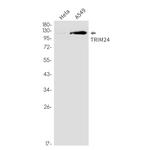 TRIM24 Recombinant Rabbit Monoclonal Antibody (K01_2P84)