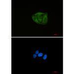 UBA52 Recombinant Rabbit Monoclonal Antibody (K01_2P88)