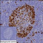 UBE2C Antibody in Immunohistochemistry (Paraffin) (IHC (P))