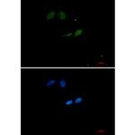 UBC9 Recombinant Rabbit Monoclonal Antibody (K01_2P90)