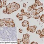 UBC9 Antibody in Immunohistochemistry (Paraffin) (IHC (P))