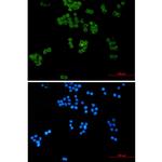 UBE2L3 Recombinant Rabbit Monoclonal Antibody (K01_2P91)