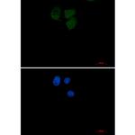 UBC13 Recombinant Rabbit Monoclonal Antibody (K01_2P92)