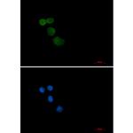 E6AP Recombinant Rabbit Monoclonal Antibody (K01_2P93)