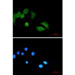 UBE4B Antibody in Immunocytochemistry (ICC/IF)