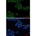 VAV2 Recombinant Rabbit Monoclonal Antibody (K01_2P98)