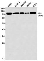 VAV2 Antibody in Western Blot (WB)
