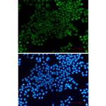 XRCC1 Recombinant Rabbit Monoclonal Antibody (K01_2Q02)