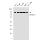 YTHDC2 Recombinant Rabbit Monoclonal Antibody (K01_2Q04)