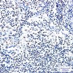 Pokemon Antibody in Immunohistochemistry (Paraffin) (IHC (P))