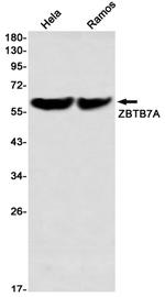 Pokemon Antibody in Western Blot (WB)