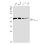 ZIPK Recombinant Rabbit Monoclonal Antibody (K01_2Q06)