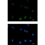 PKC beta Antibody in Immunocytochemistry (ICC/IF)
