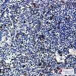 PKC beta Antibody in Immunohistochemistry (Paraffin) (IHC (P))