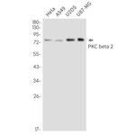 PKC beta Antibody in Western Blot (WB)