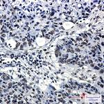 H4K5ac Antibody in Immunohistochemistry (Paraffin) (IHC (P))