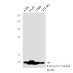 H4K5ac Antibody in Western Blot (WB)