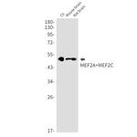 MEF2A/MEF2C Recombinant Rabbit Monoclonal Antibody (K01_2Q14)