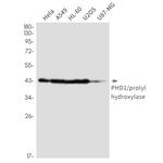 PHD1 Recombinant Rabbit Monoclonal Antibody (K01_2Q15)