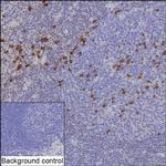 Human IgG4 Recombinant Rabbit Monoclonal Antibody (K01_2Q16)